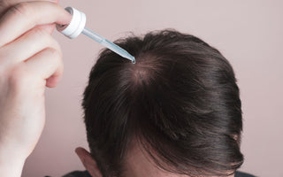 Why Minoxidil in 2024 remains the GOLD standard for treating hair loss